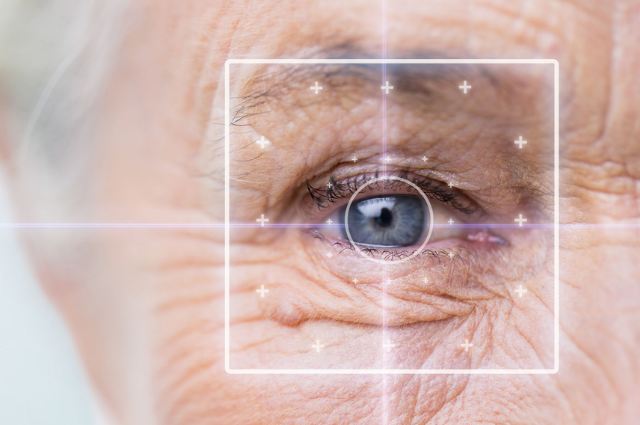 CIRURGIAS DE RETINA