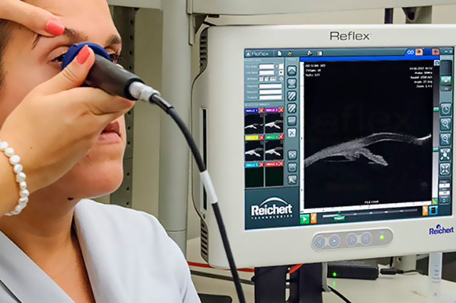 ULTRASSONOGRAFIA OCULAR